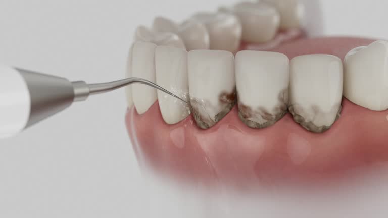 Reliable Dental Implants contractor in Franklin, CA by Smile Center Dentistry